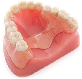 prótesis flexible dental