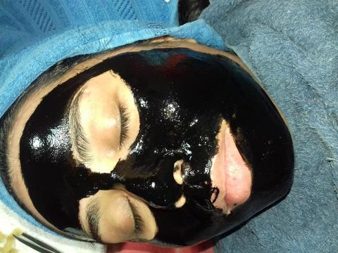 Limpieza de cutis con mascara de carbon